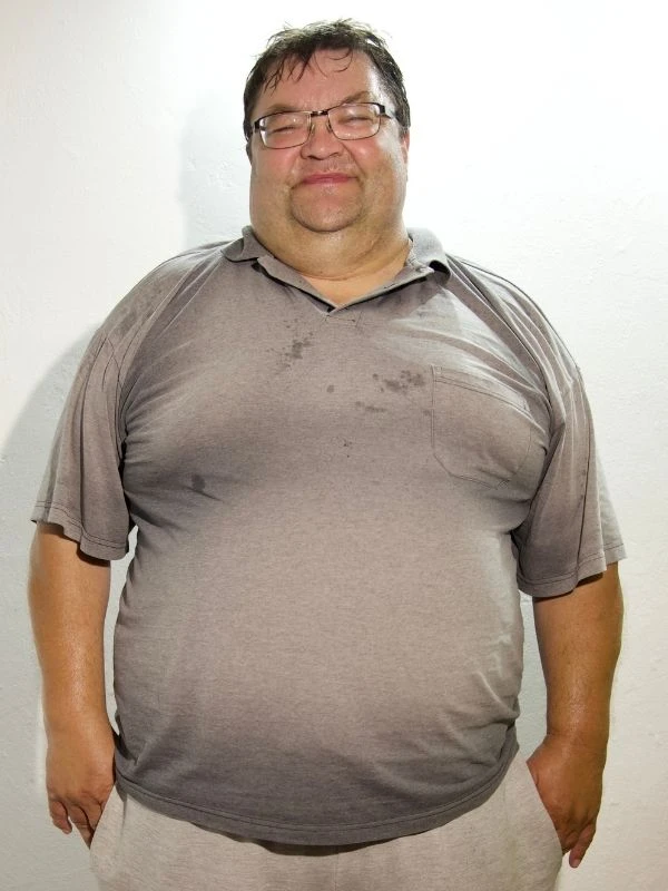 Petr pred chudnutím s EASYDIET krabičkovou diétou