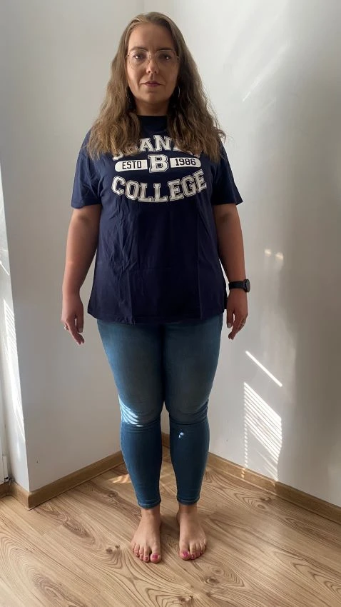 Simona po chudnutí s krabičkovou diétou easydiet