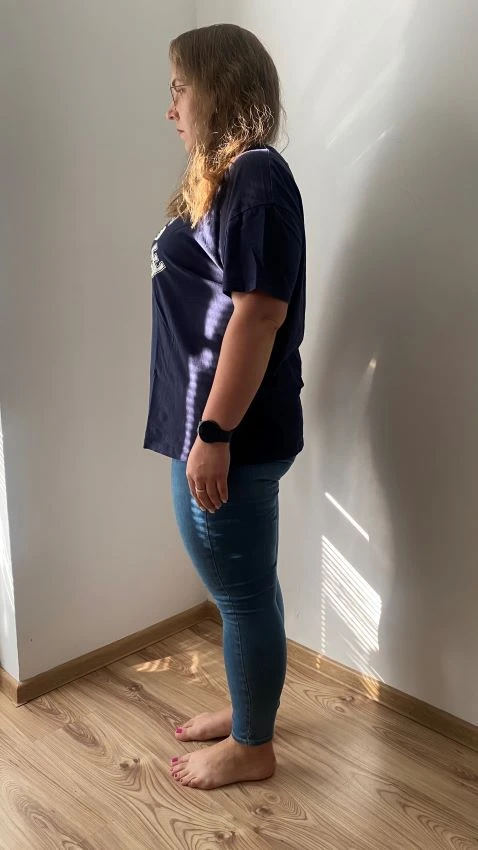 Simona po chudnutí s krabičkovou diétou easydiet