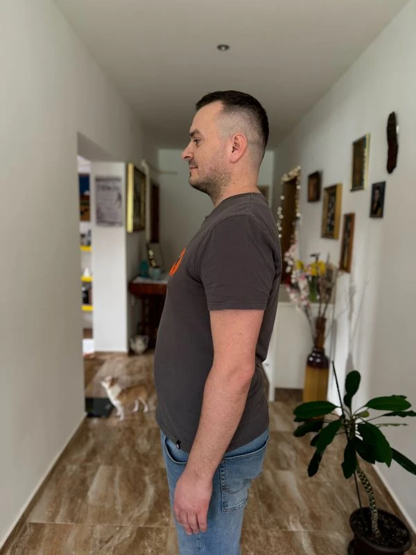 Imrich pred chudnutím s EASYDIET