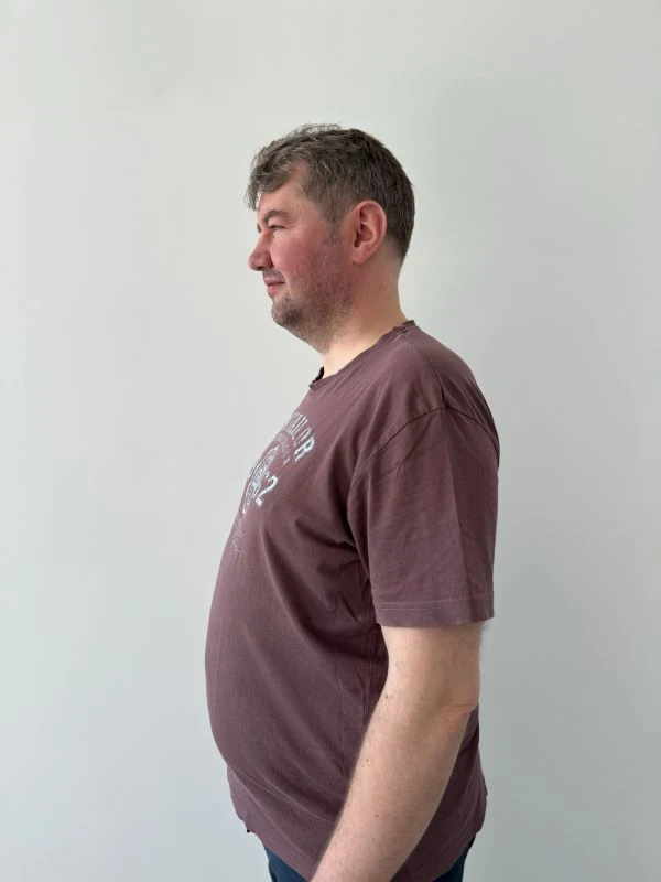 Kamil pred chudnutím s krabičkovou diétou